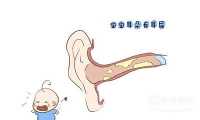 宝宝正常耳屎图片
