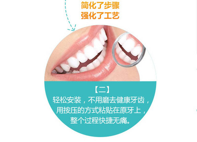 去医院做一颗贴面要多少钱