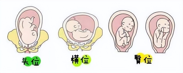 宝宝在肚子里的姿势