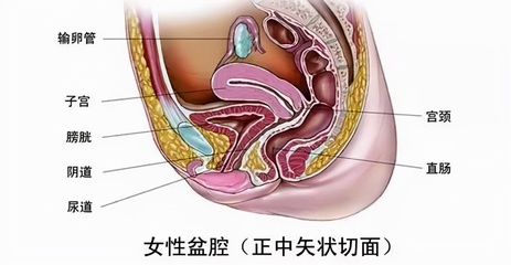 怀孕后盆腔炎发作怎么办