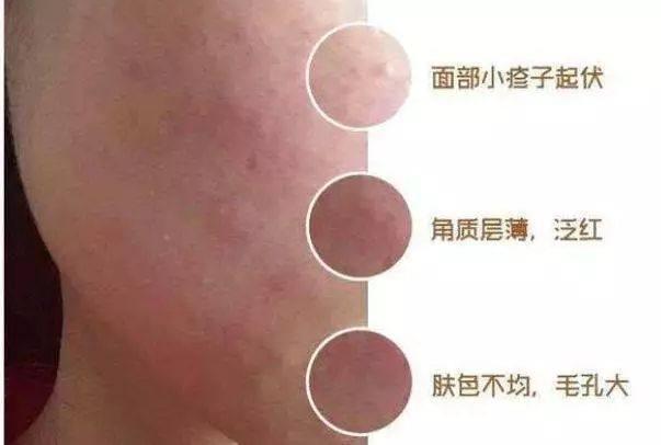密妆面膜效果怎么样