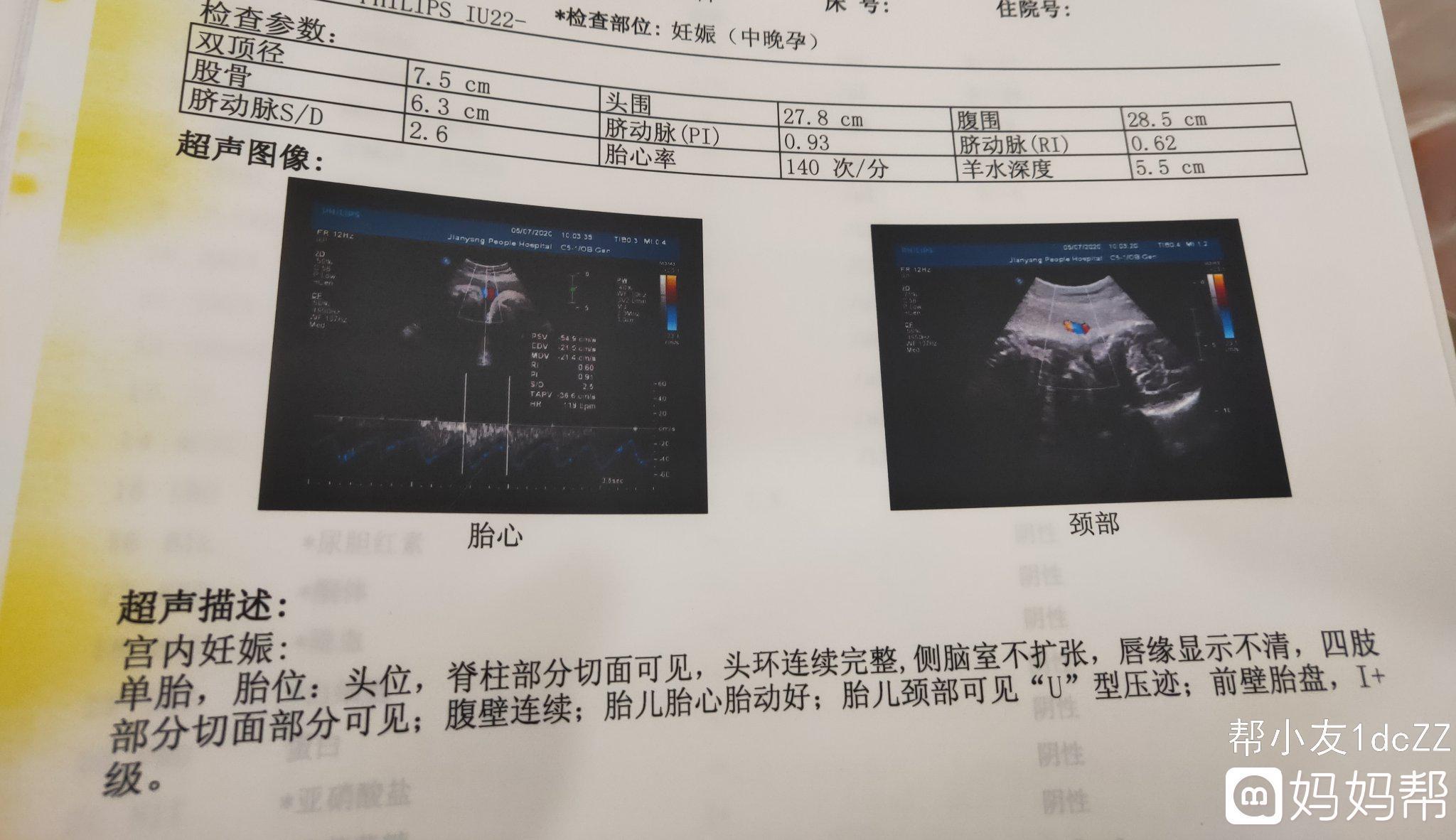 怀孕32周需要做什么检查