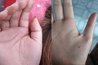 右手发麻是怎么回事