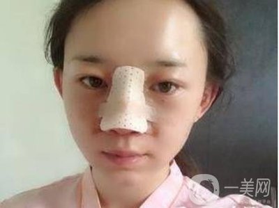 取耳软骨隆鼻疼吗
