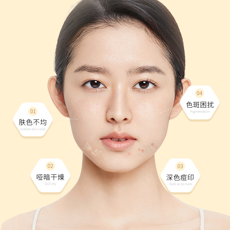 脸上好多痘印痘痘可以用维e吗