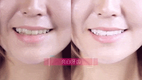 牙齿总有色素沉淀和体质有关系吗