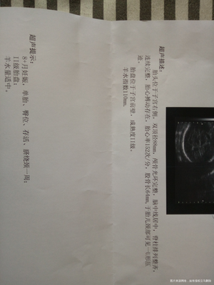 怀孕36周孩子一般几斤