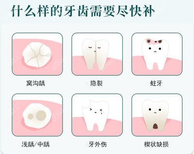 补牙价格