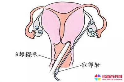 卵泡多怎么治疗