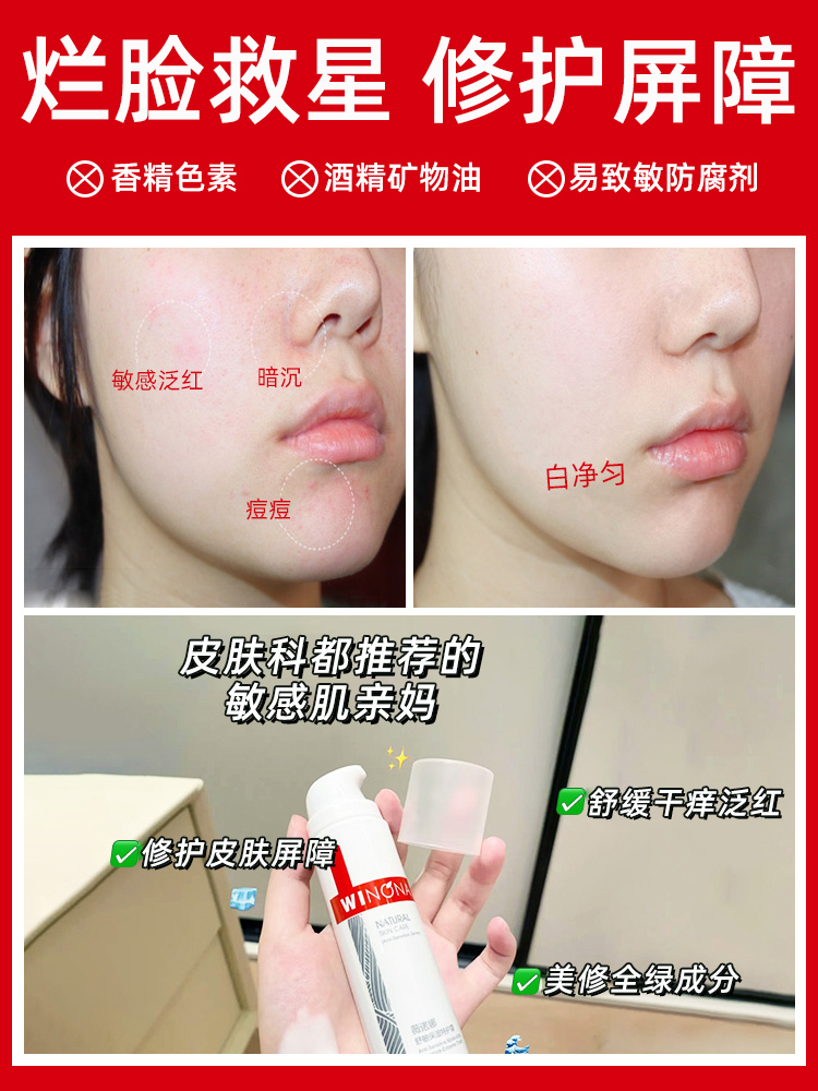 脸上的痘痘有什么分类