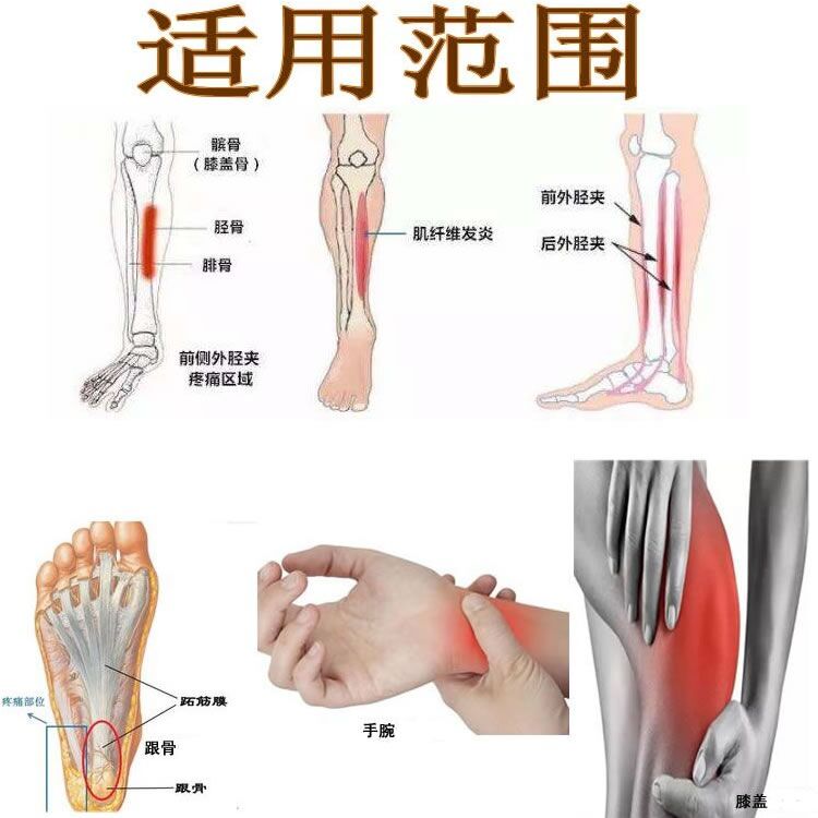 腓骨痛是怎么回事