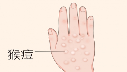 痘痘结痂可以珍珠粉