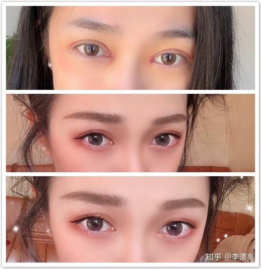 美丽的双眼皮