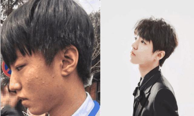 痘痘结巴了怎么上妆