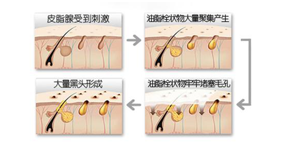 毛孔有白色条状物